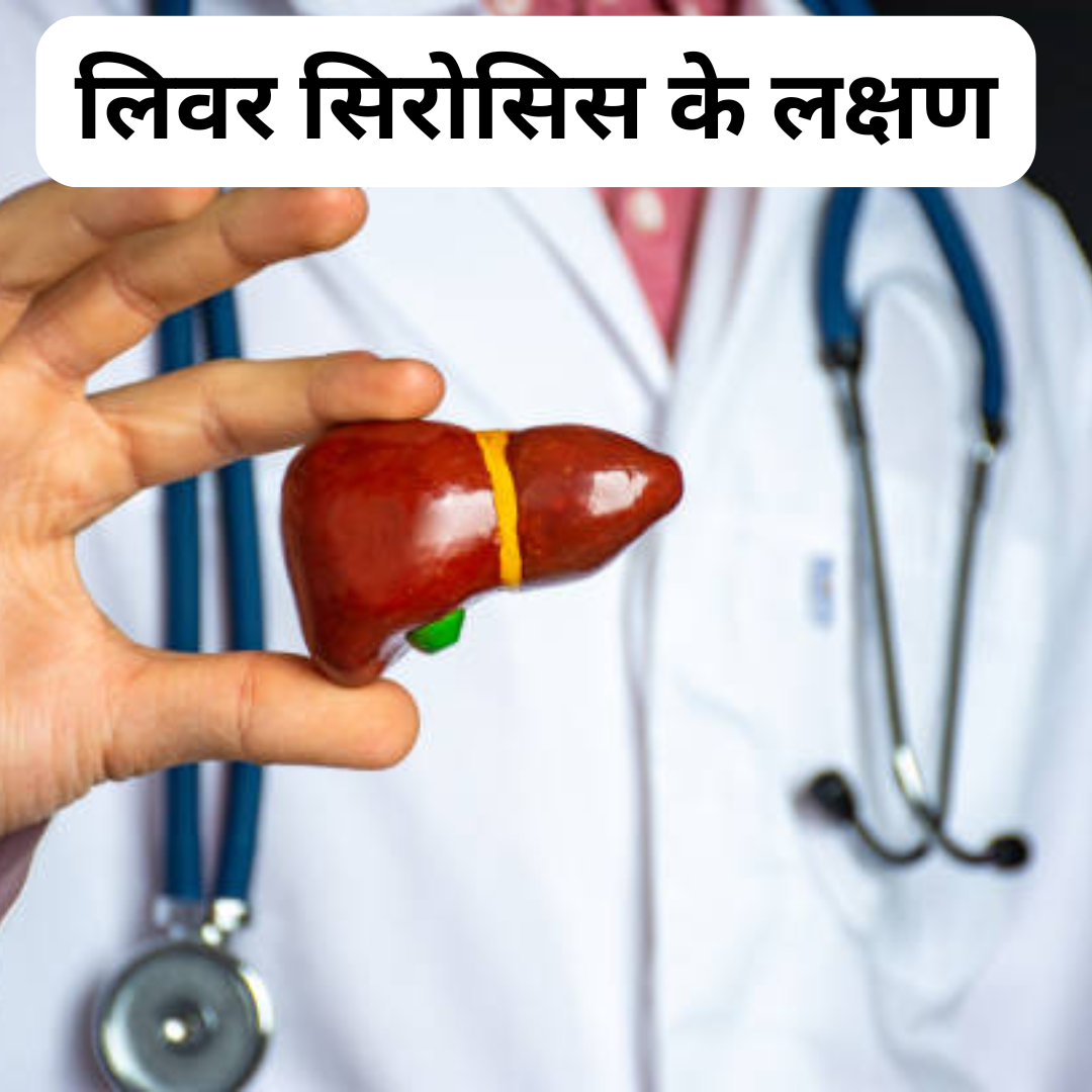 लिवर सिरोसिस से लक्षण