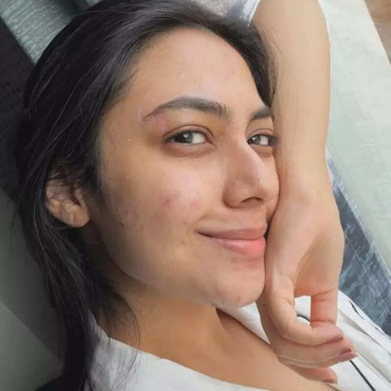 रीम शेख का चेहरा हुआ ठीक