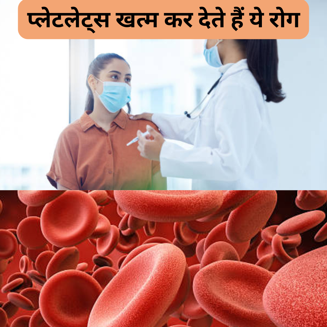 किन बीमारियों में गिरते हैं प्लेटलेट्स