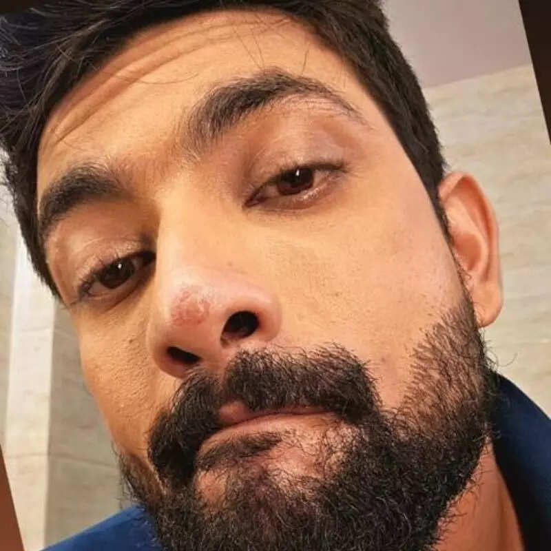 फहमान खान शूटिंग के दौरान हुए घायल