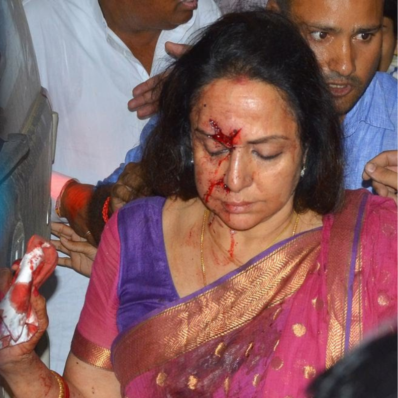 एक्सीडेंट में फट गया था हेमा मालिनी Hema Malini का सिर