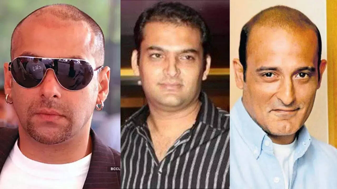 कम उम्र में गंजे हुए ये स्टार्स