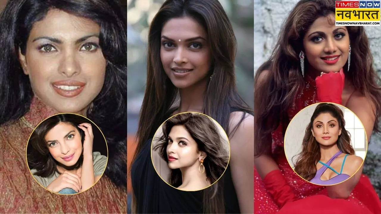 सावंली से गोरी हुई ये 7 बॉलीवुड हसीनाएं सर्जरी का लिया सहारा