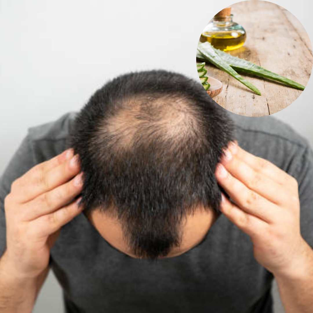 एलोवेरा जेल के फायदे