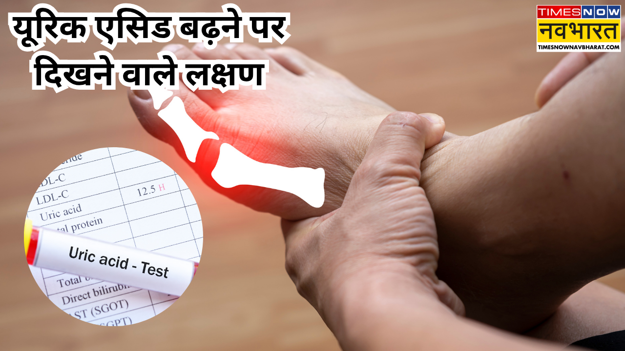 यूरिक एसिड बढ़ने पर दिखते हैं ये लक्षण
