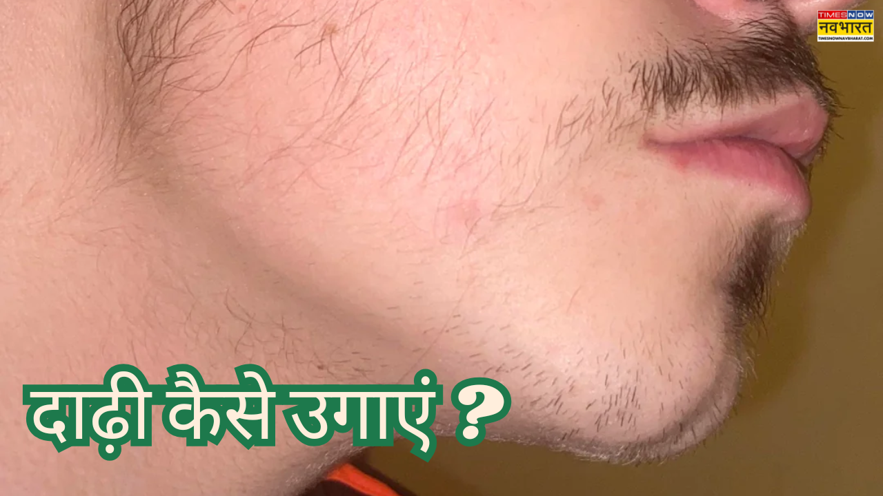 पैची बीयर्ड से हैं परेशान