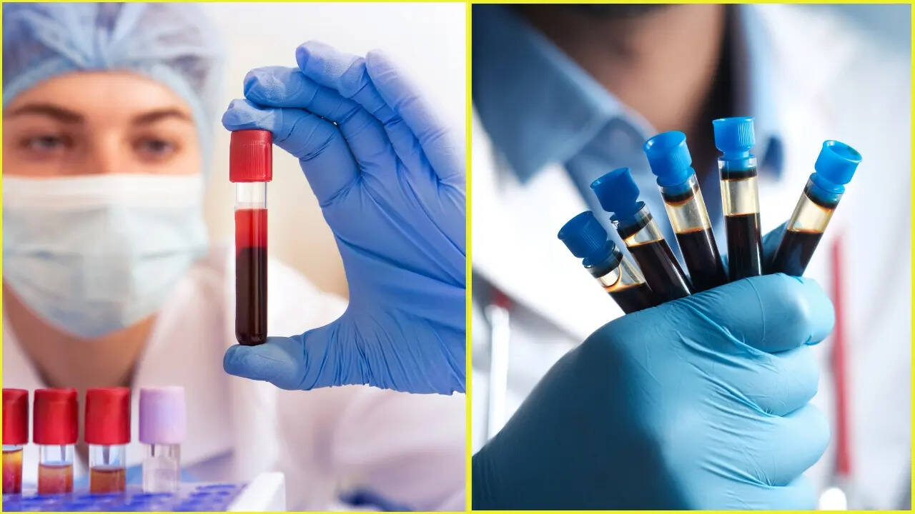 Know more about Pinprick Blood test that could detect disease 10 years ...