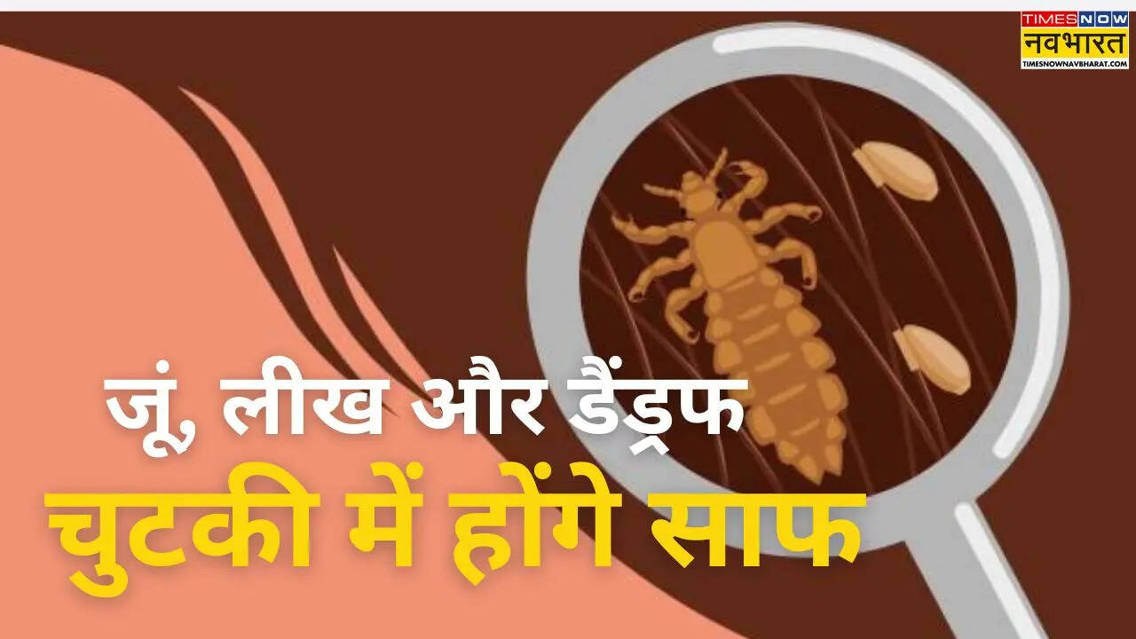 जूं का जीना मुश्किल कर देगा ये देसी जुगाड़