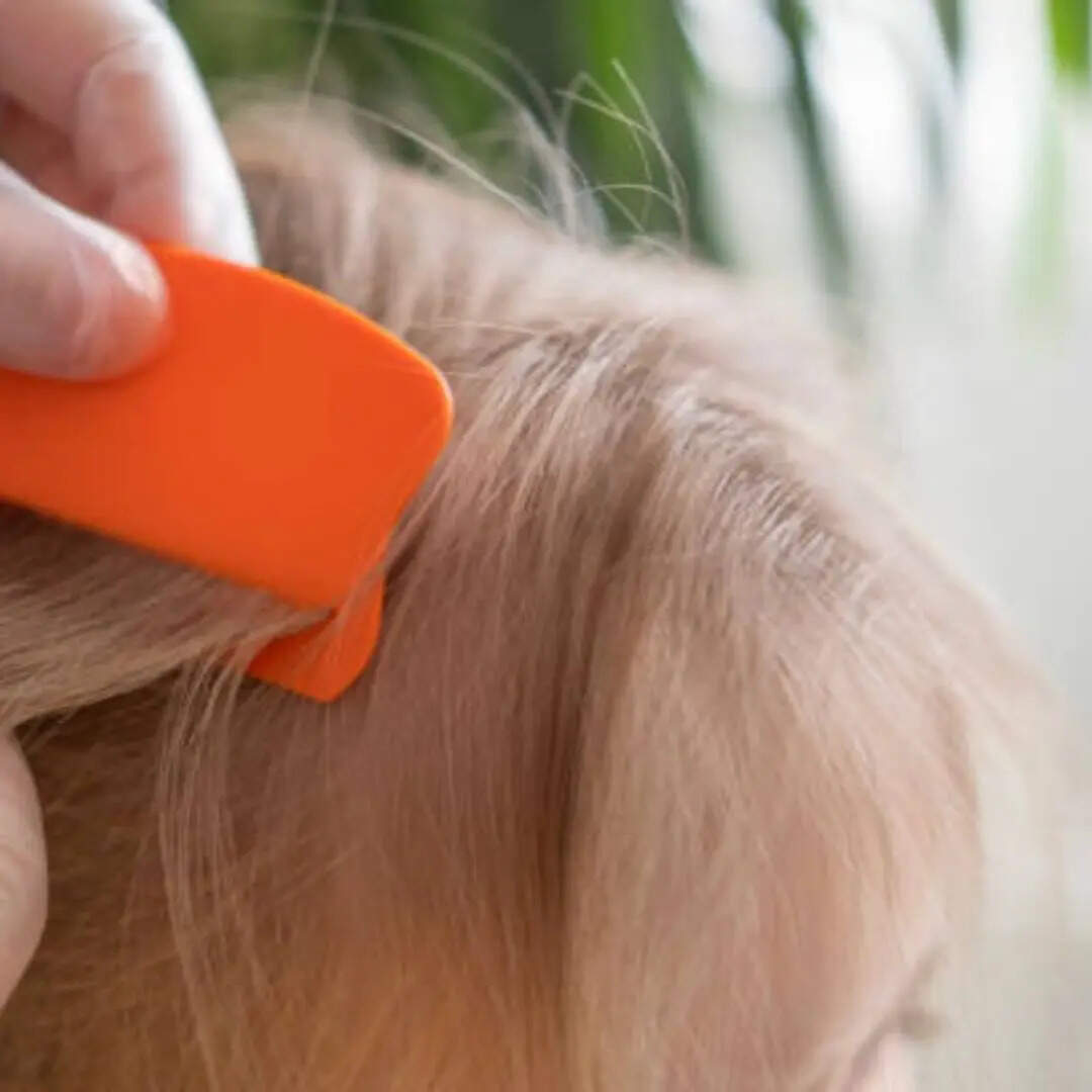 डैंड्रफ भी होंगे साफ