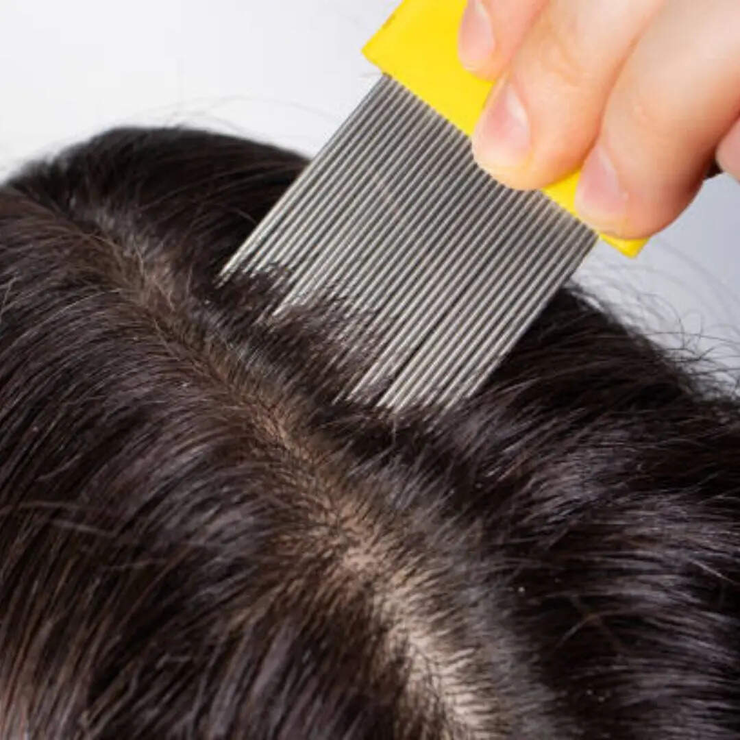 लीख भी नहीं बच पाते