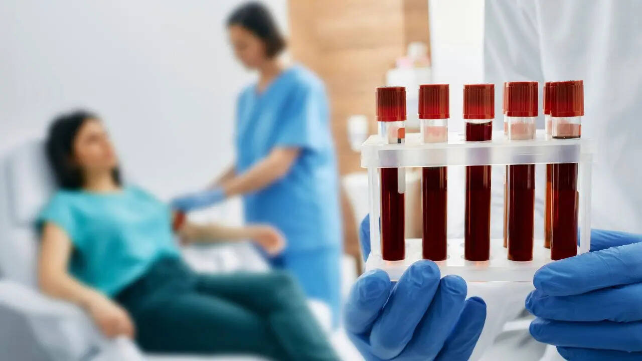 बॉम्बे बल्ड ग्रुप की पहचान मुश्किल