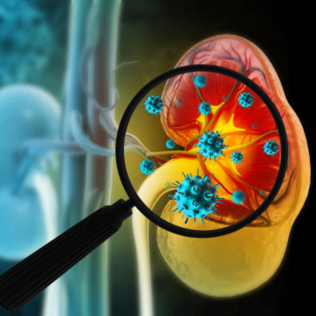 ज्यादा नमक वाली चीजें 