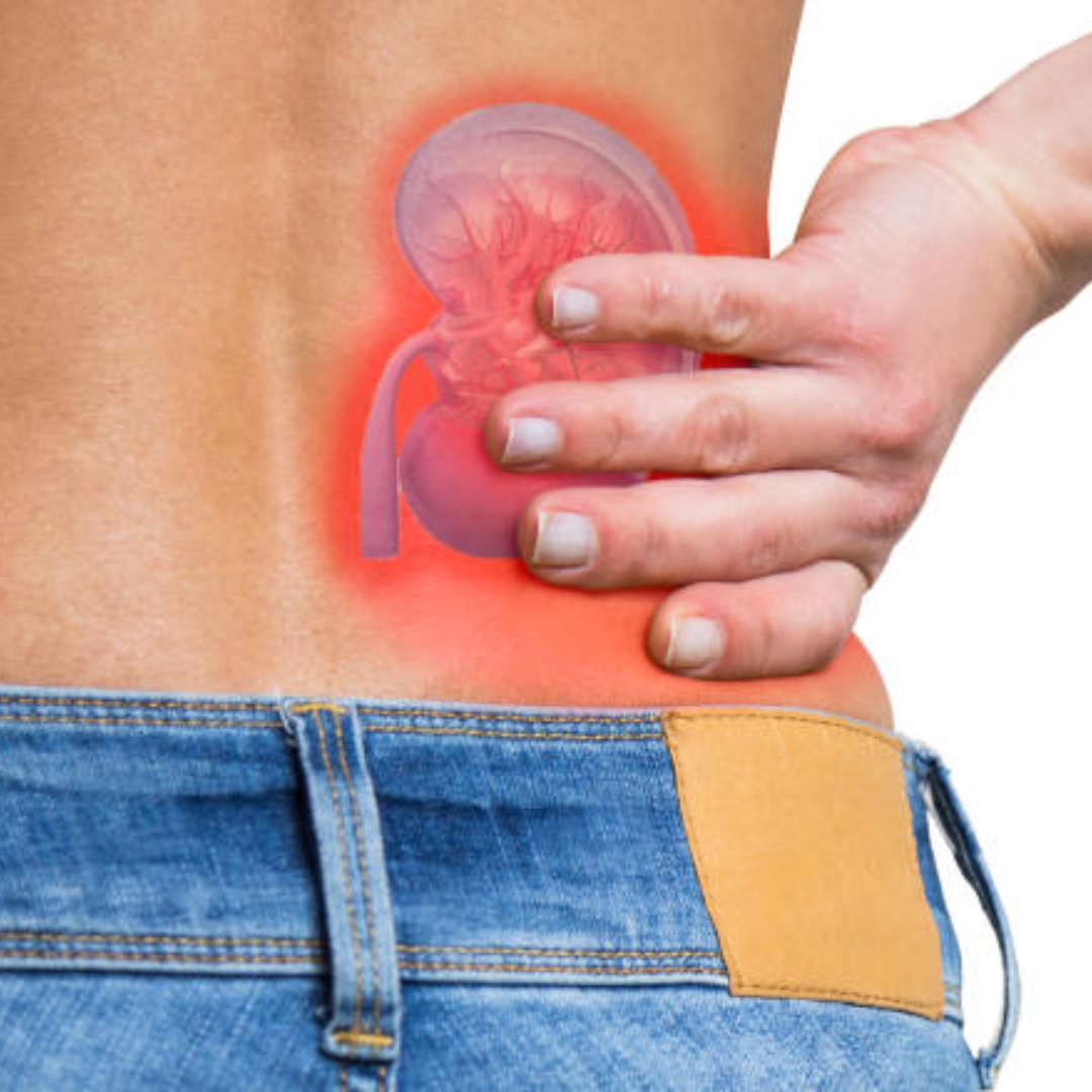 पथरी के मरीज क्या न खाएं