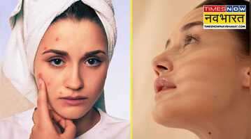 चेहरे की चमक छीन सकते हैं ये 5 फूड्स कहलाते हैं स्किन के दुश्मन