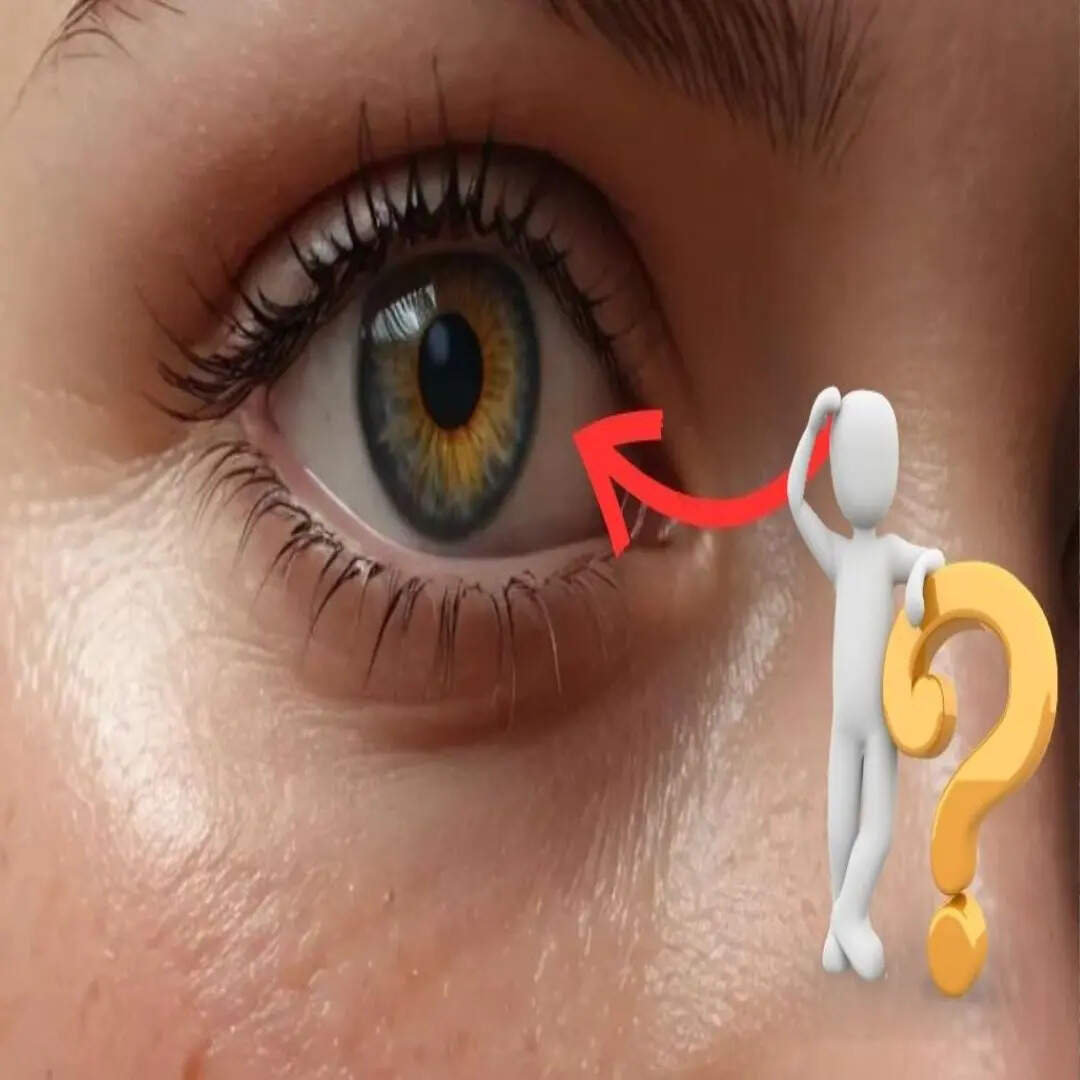 ​क्या कहलाता है यह?