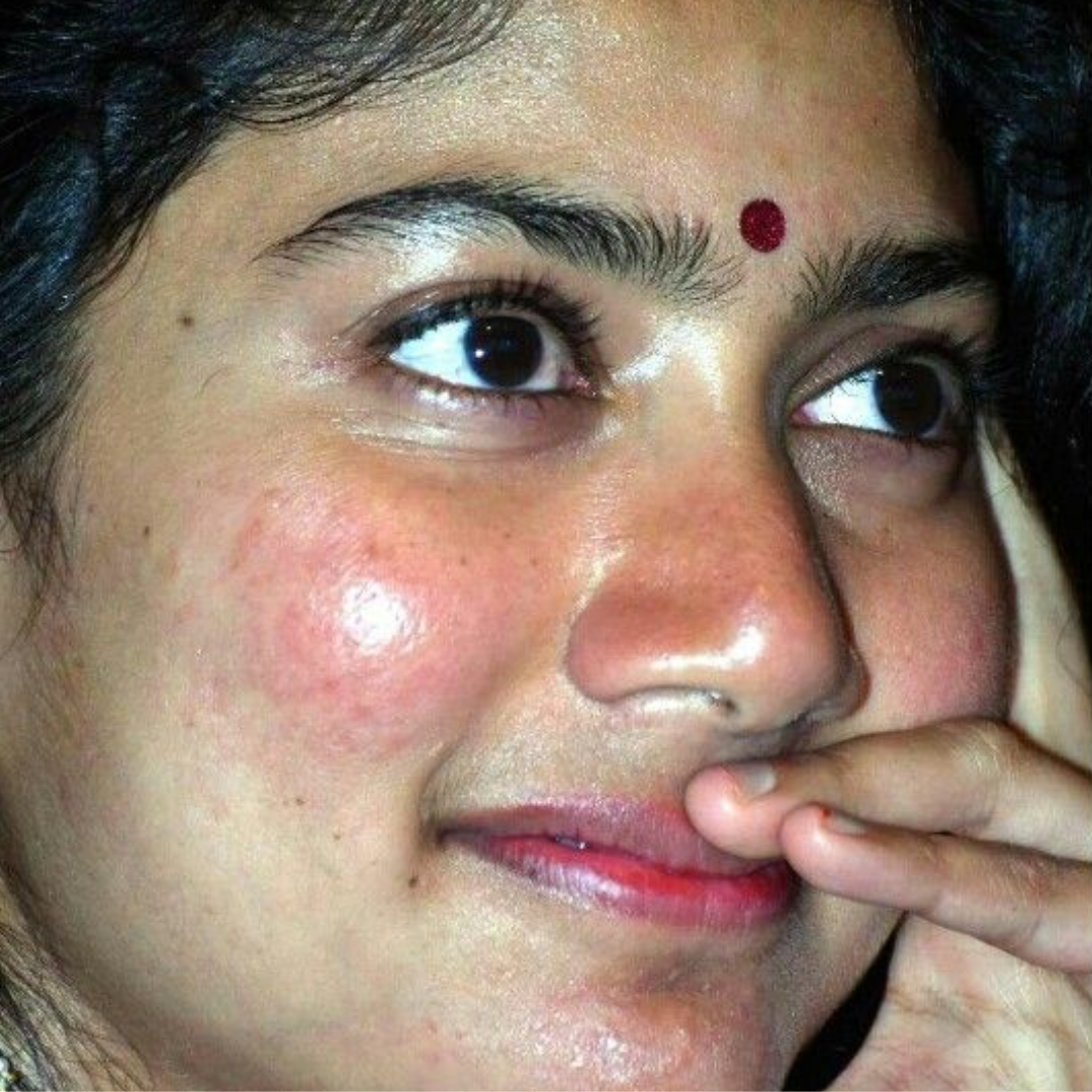इसके लक्षण क्या हो सकते हैं?