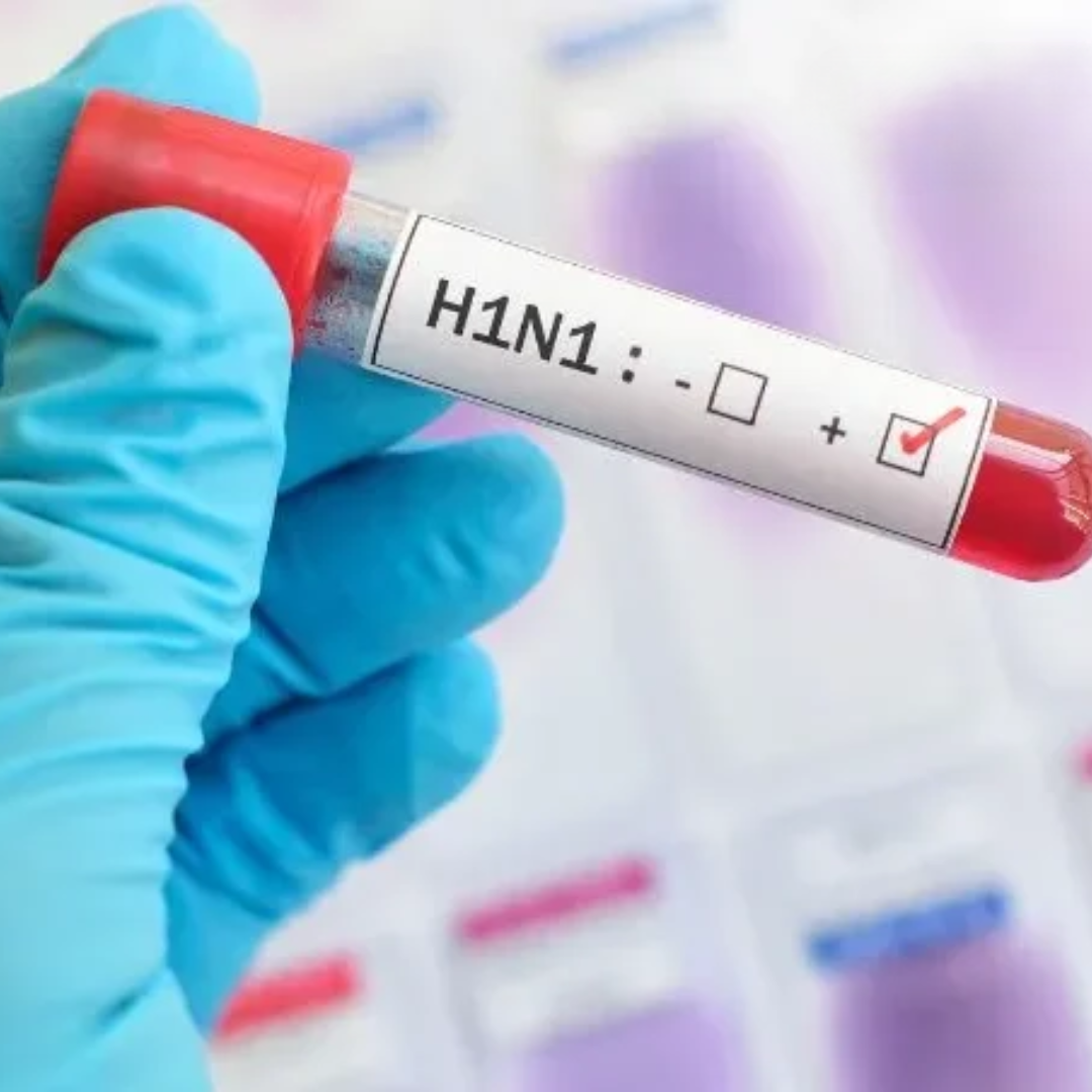 H1N1 के लक्षण क्या हैं