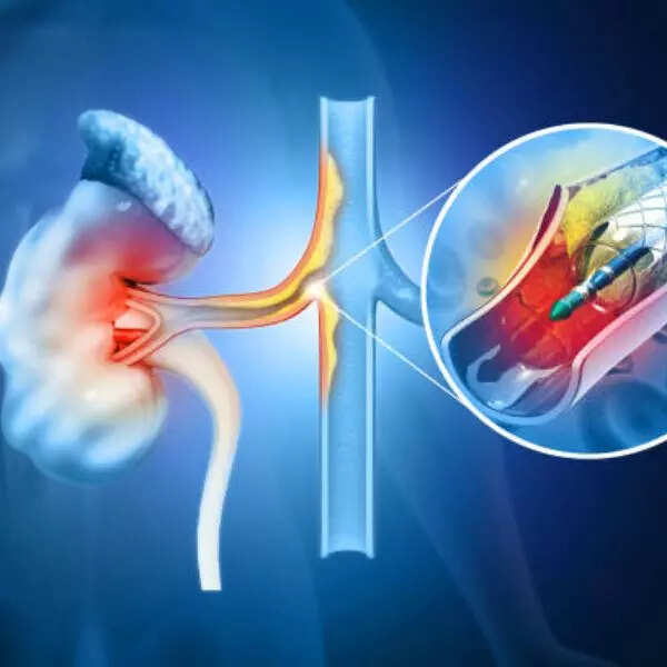 कोलेस्ट्रोल को करे नियंत्रित
