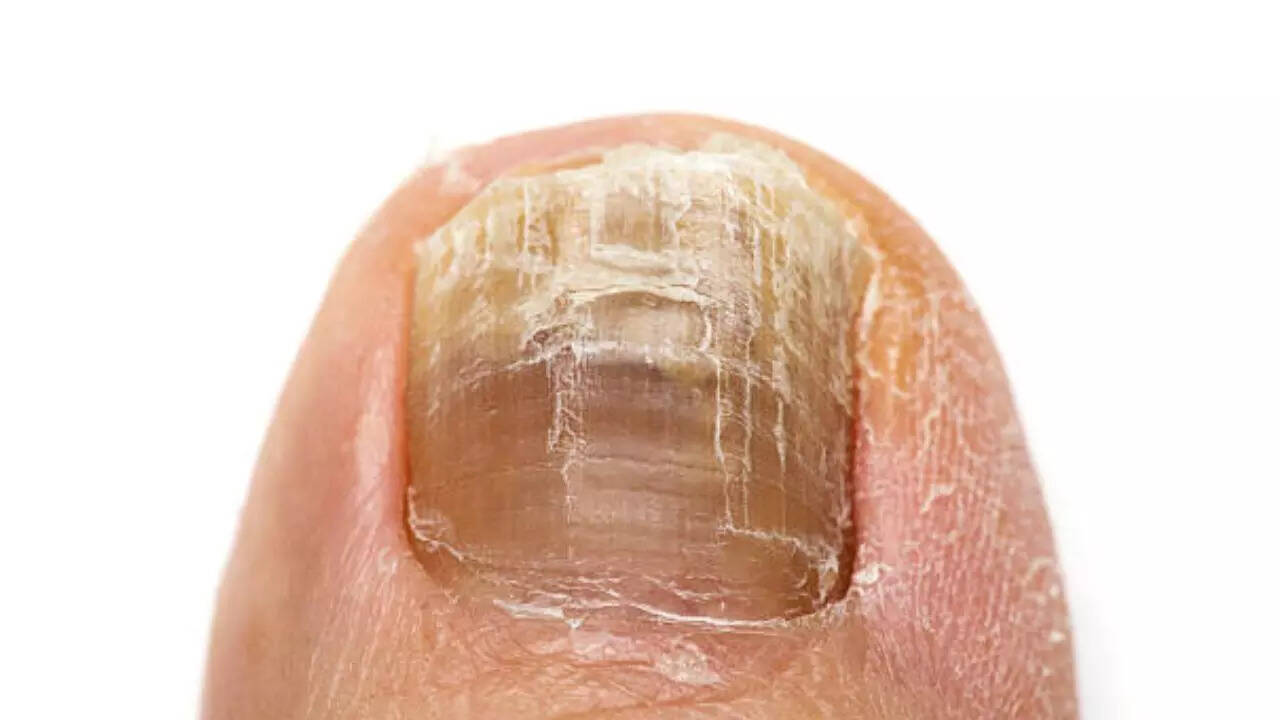Nail care