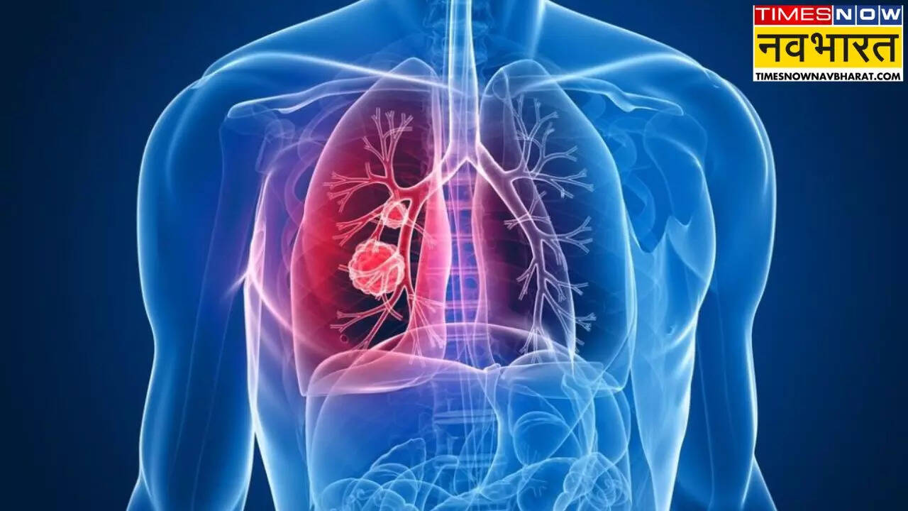 Lung cancer