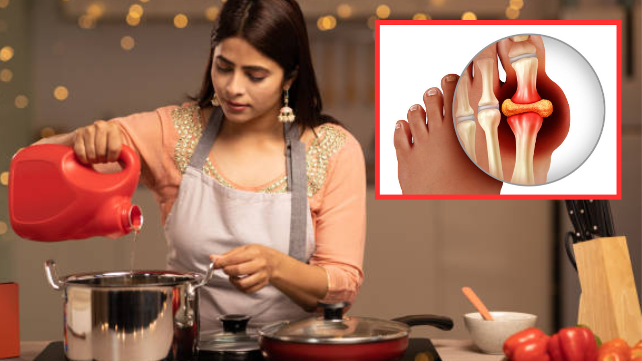 Uric Acid Mein Kaun Sa Tel Khana Chahie