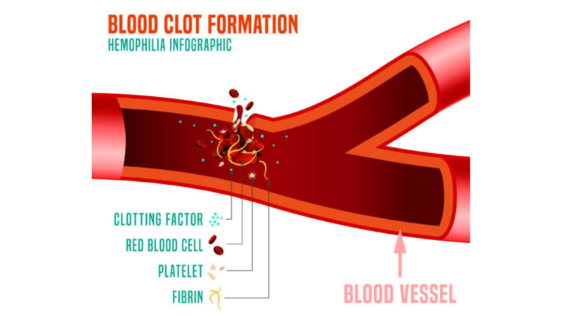 Why Is World Hemophilia Day Is Celebrated In Hindi