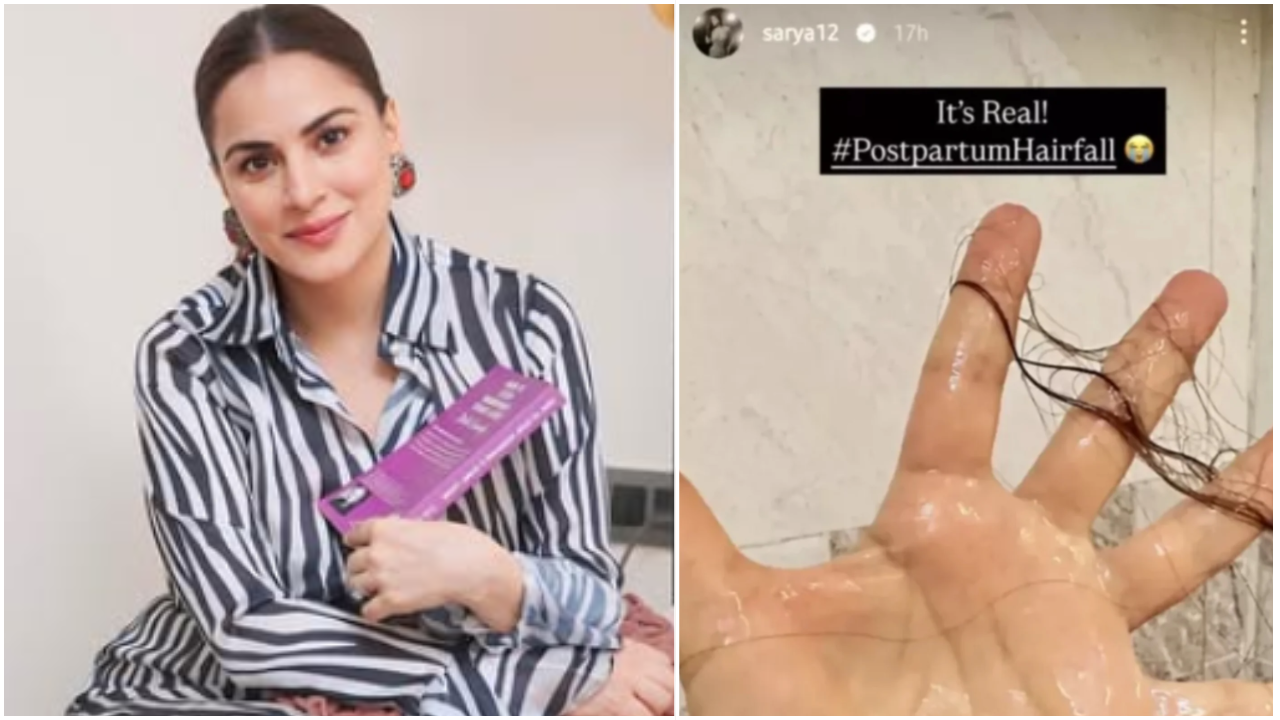 Shraddha Arya Postpartum Hair Loss