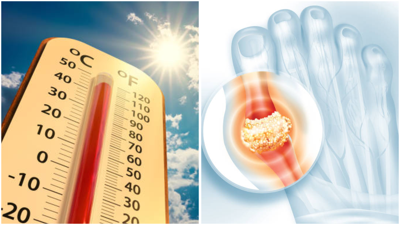 Fruits To Control Uric Acid In Summer In Hindi