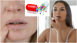 Lip Balm लगाने पर भी बार-बार फंट जाते हैं होंठ हो सकती है शरीर में इन चीजों की कमी सेहत के लिए है बड़ा खतरा