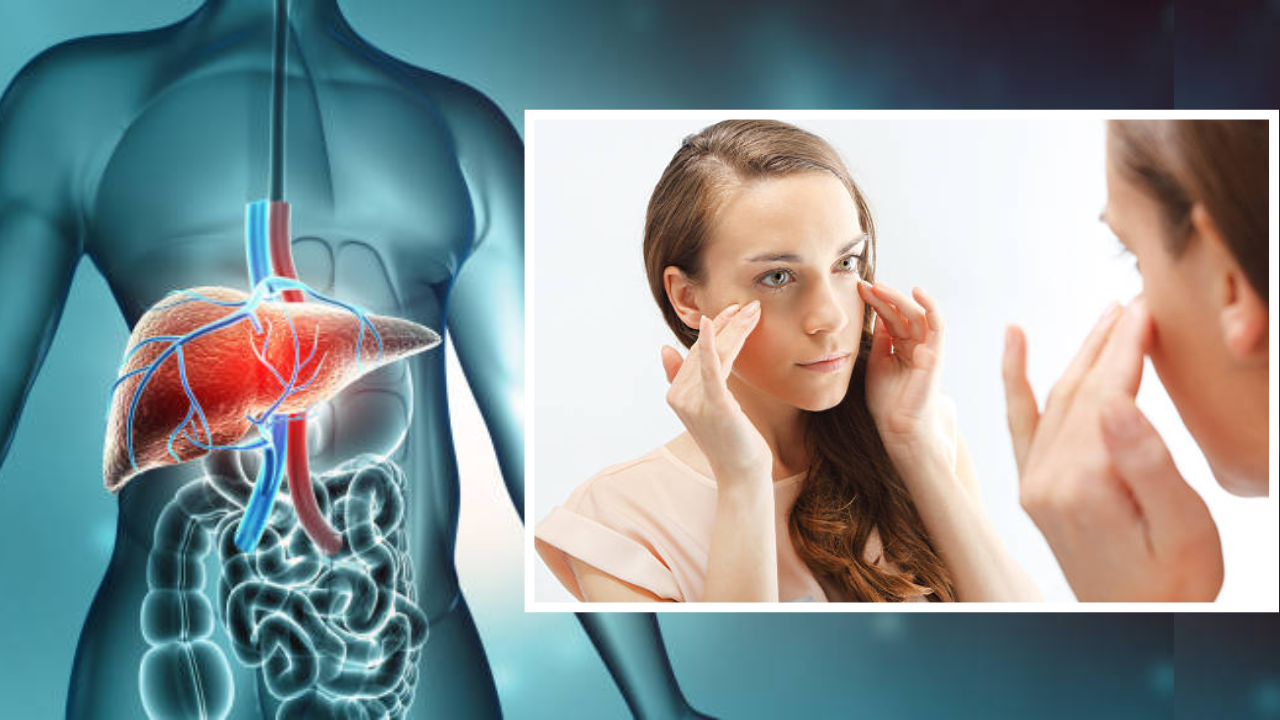 Symptoms Of liver Problems On Skin In Hindi
