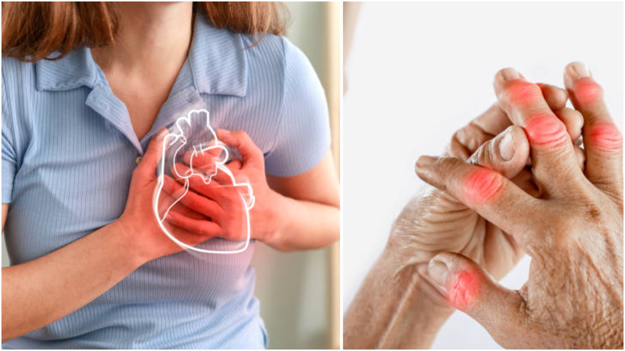 High Uric Acid Can Increase Heart Disease Risk