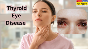 World Thyroid Day आंखों की रोशनी भी छीन लेता है थायराइड जाने क्या है Thyroid Eye Disease इसके लक्षण और बचाव के उपाय