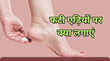 फटी एड़ियों पर क्या लगाएं कि पैरों से राजरानी हो जाएं नारियल तेल से नींबू-नमक तक देखें Cracked Heels के घरेलू उपाय
