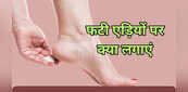 फटी एड़ियों पर क्या लगाएं कि पैरों से राजरानी हो जाएं, नारियल तेल से नींबू-नमक तक देखें Cracked Heels के घरेलू उपाय