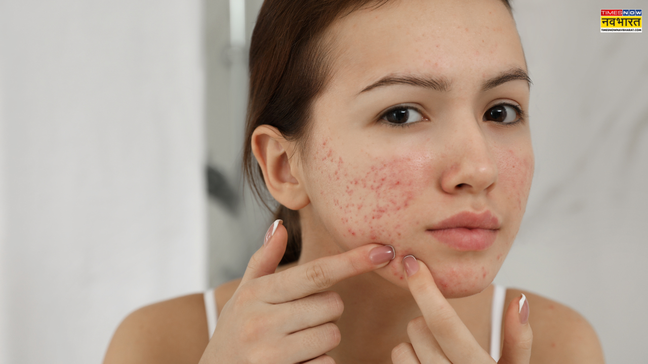 Nunca apliques estas cosas en tu cara