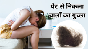 14 साल की लकड़ी की पेट से निकला 2 मीटर लंबा बालों का गुच्छा पेट दर्द की शिकायत लेकर पहुंची थी अस्पताल