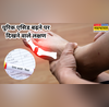 यूरिक एसिड बढ़ने पर पैरों में दिखते हैं ये गंभीर लक्षण इग्नोर करने पर चलना-फिरना भी मुश्किल