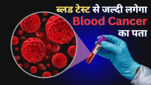 अब खून की जांच से चल सकेगा ब्लड कैंसर का पता वैज्ञानिकों ने बनाया खास Blood Test रिसर्च में पाया गया कारगर