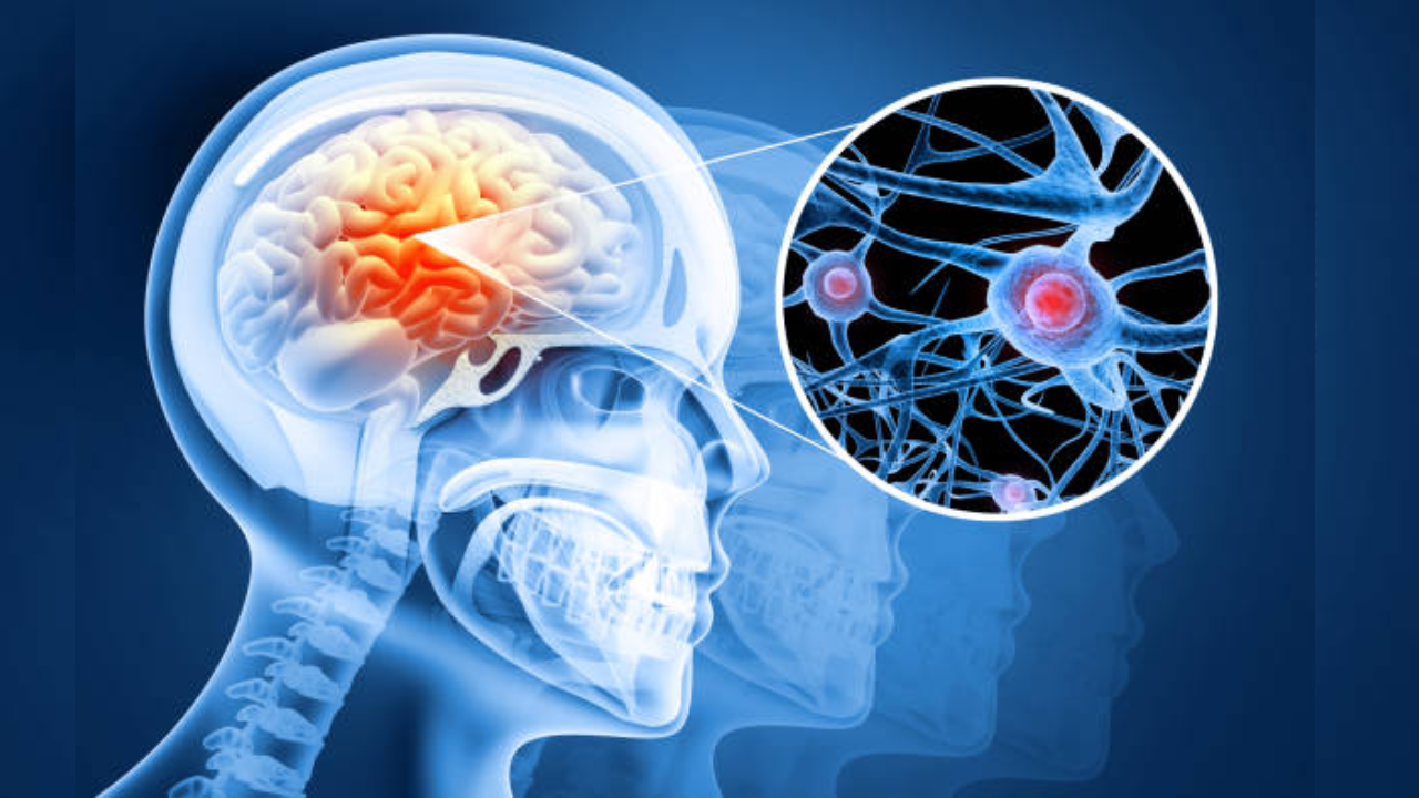 Líquido en síntomas de hidrocefalia cerebral en hindi
