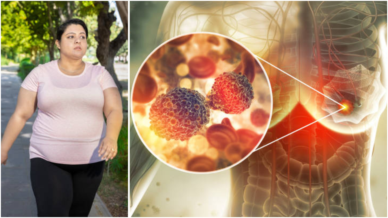 Obesity Increase Risk Of Breast Cancer