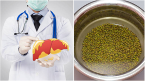 लिवर में जमा हो गया है जिद्दी फैट मोम की तरह पिघला सकता है इस दाल का पानी Fatty Liver के लिए है वरदान