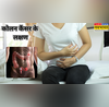 युवाओं में तेजी से बढ़ रहा कोलन कैंसर जानें कैसे दिखते हैं लक्षण और कब जरूरी है जांच
