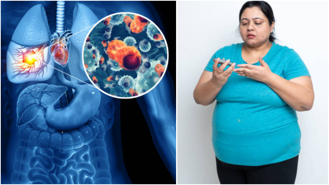 La relación entre diabetes y tuberculosis