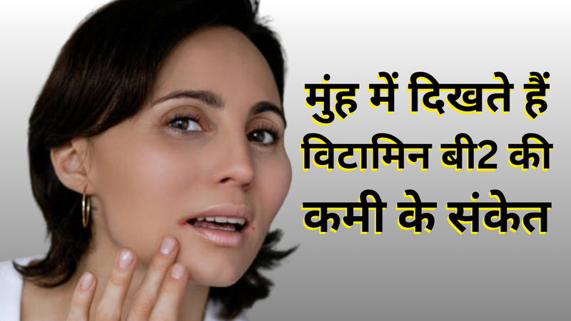 Vitamin B2 Riboflavin Deficiency Signs And Symptoms