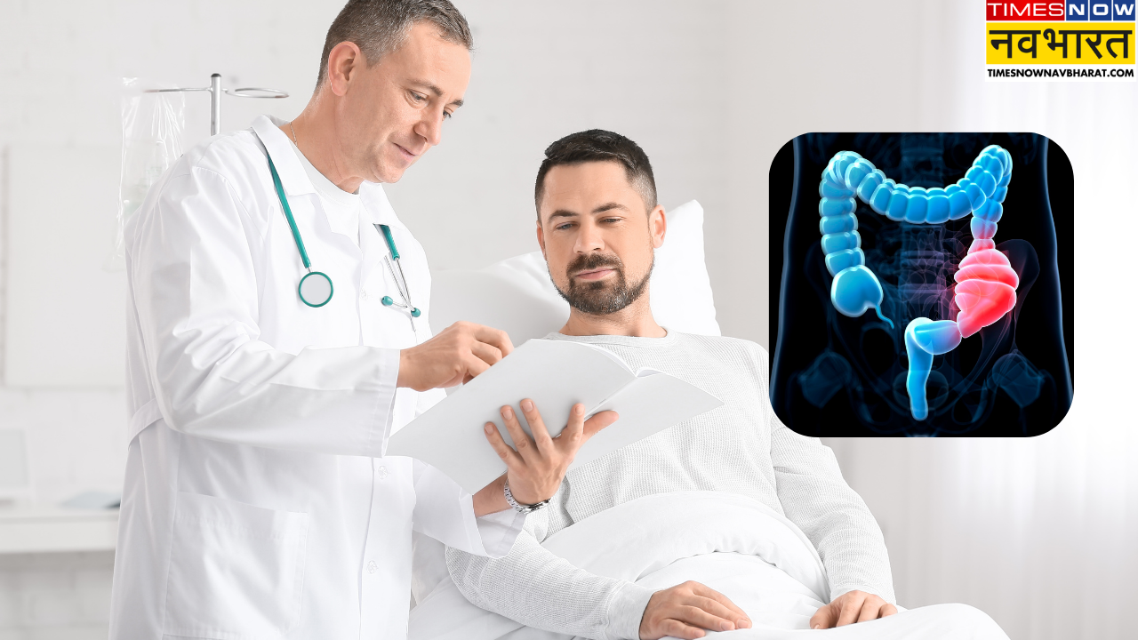 Colon Cancer