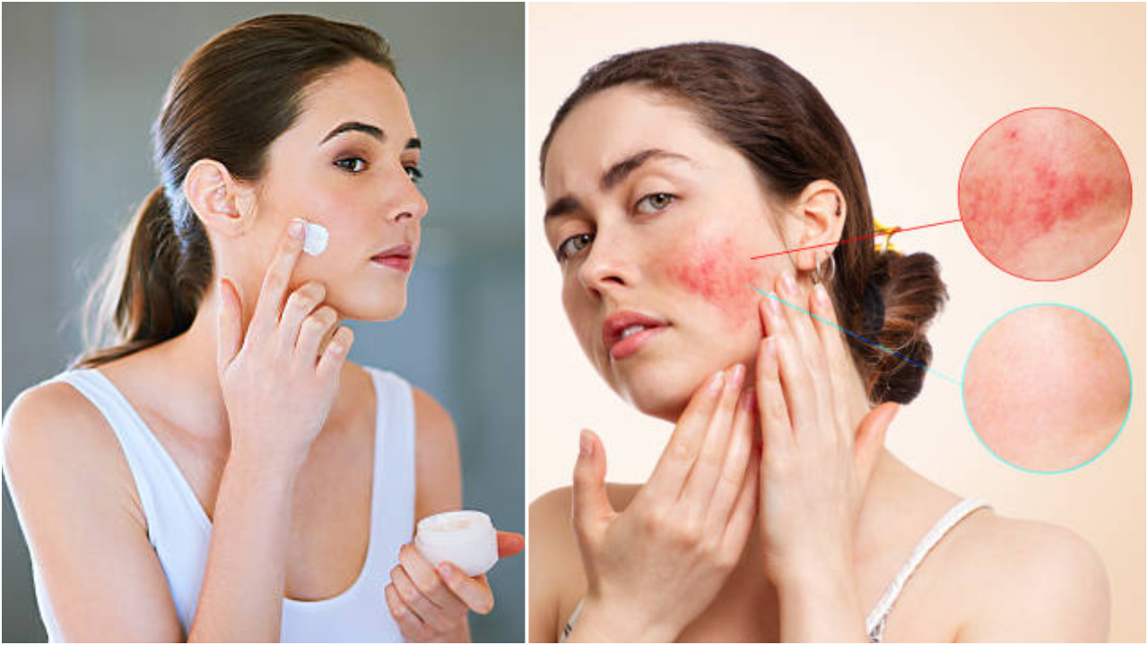 Fairness Cream Side Effects In Hindi