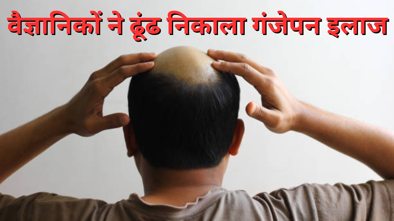 PP405 Hair Regrowth Solution