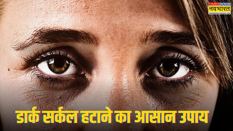 Dark Circle removal tips