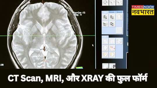 क्या होती है CT Scan MRI और XRay की फुल फॉर्म अच्छे-अच्छों को नहीं होगा मालूम