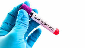 आंध्र प्रदेश में स्क्रब टाइफस का कहर, राज्यभर में 1,500 से अधिक मामले, अबतक 9 लोगों की मौत